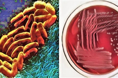 Morphology And Culture Characteristics Of Pseudomonas aeruginosa