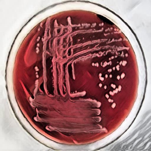klebsiella pneumoniae on blood agar medium - laboratory hub - klebsiella on lood agar