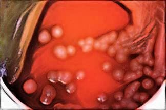 pseudomonas aeruginosa on blood agar - laboratory hub - p aeruginosa on blood agar medium