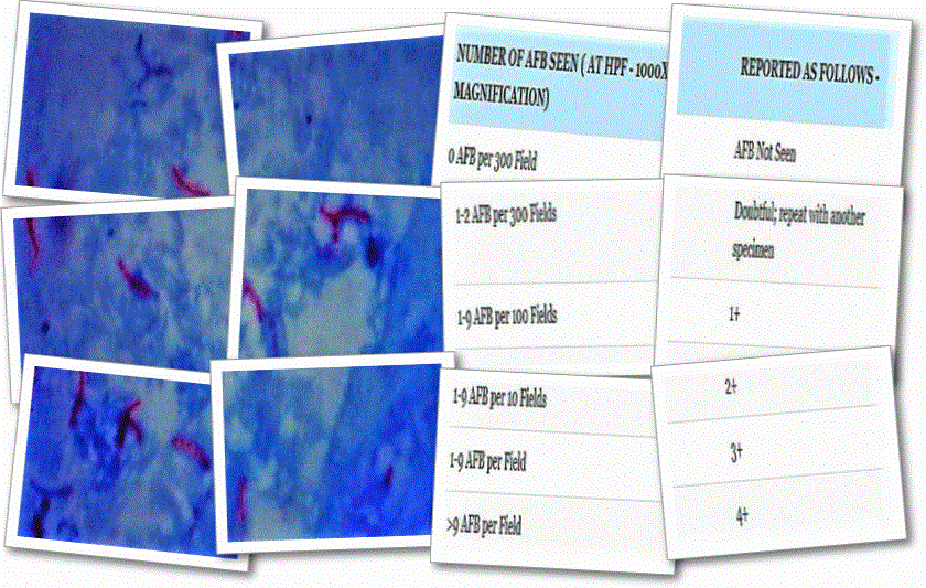 acid fast staining - results of acid fast staining - result of afb staining - laboratory hub - reporting of afb smear - afb smear reporting - microbilogy practicals