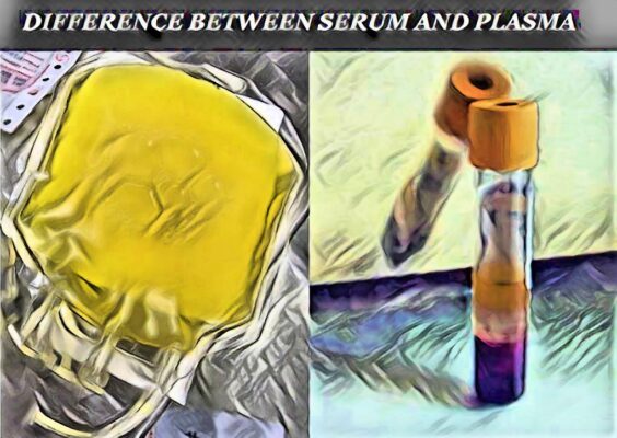 Top 15 Difference Between Serum And Plasma | Laboratory Hub