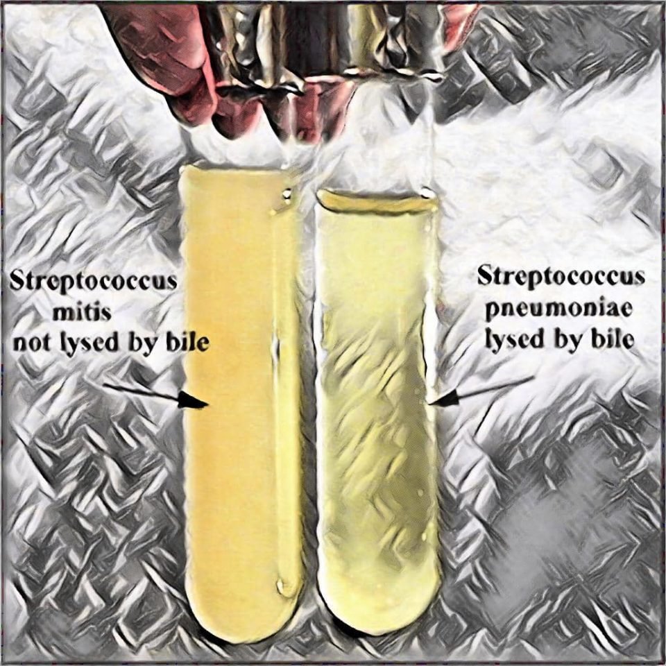 bile solubility test - streptococcus pneumoniae - pneumococcus bile test