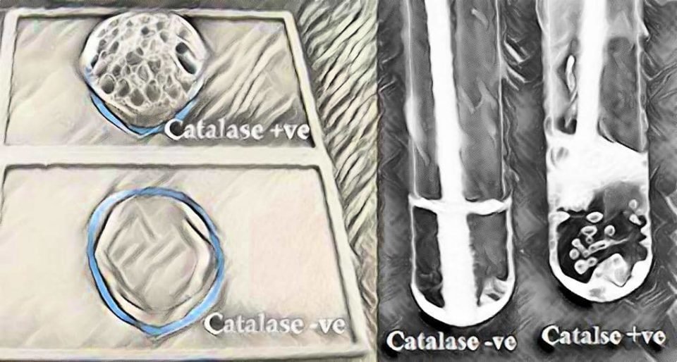 principle of catalase - procedure - uses - interpretation of catalase test - slide method - tube method - catalase positive -catalase negative