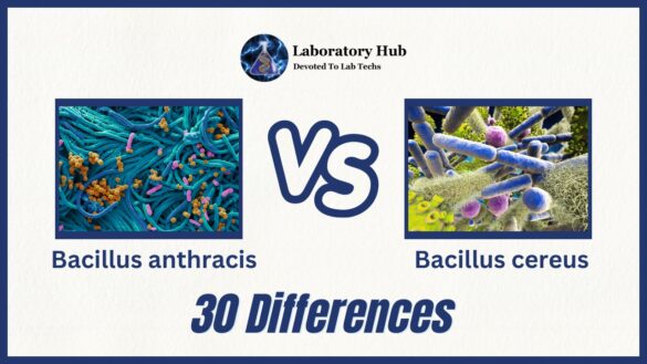 Bacillus Anthracis Vs Bacillus Cereus - 30 Differences