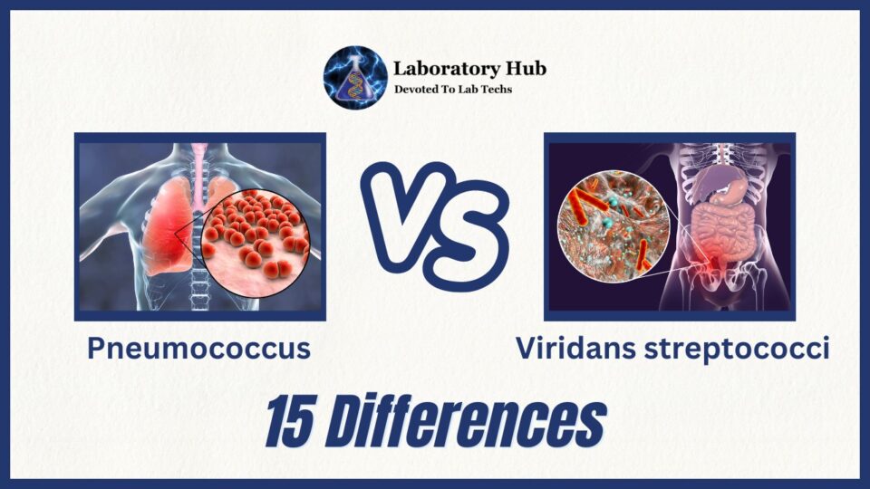 Pneumococcus vs Viridans streptococci- 15 Major Differences