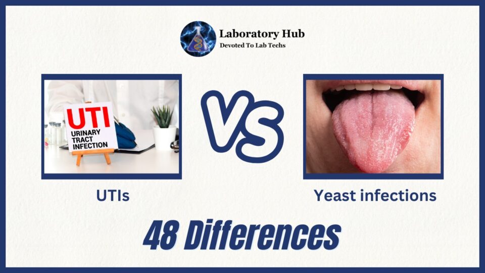 48 differences between UTIs and yeast infections